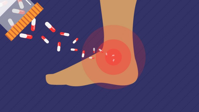 12% of Patients with Sprained Ankles filled a prescription for Opioids