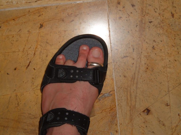 Podiatrist sued for chopping off wrong toe