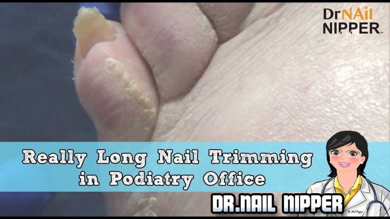 There is a Podiatrist named Dr. Nail Nipper
